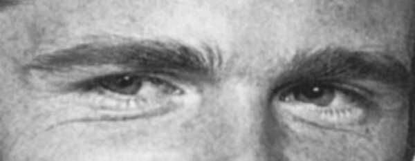 Eyes