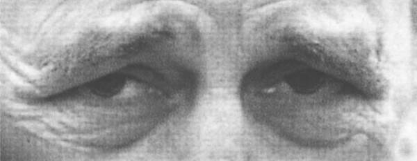 Eyes