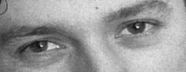 Eyes