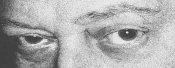 Eyes
