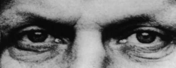 Eyes