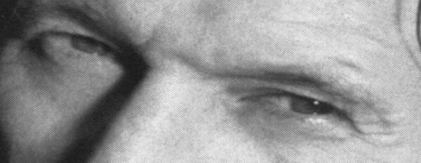Eyes