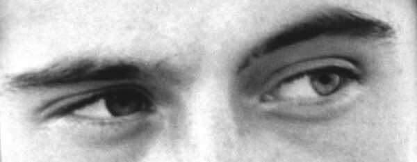 Eyes